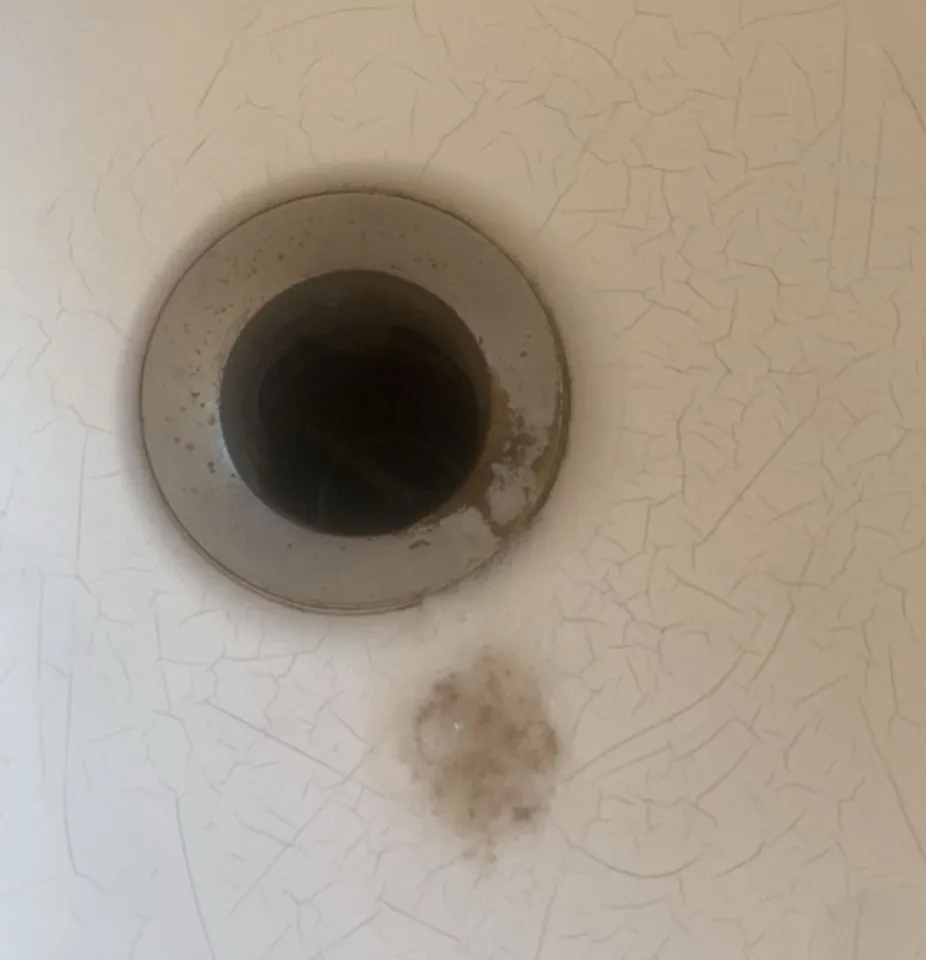 C&ocirc; g&aacute;i 21 tuổi bị ung thư phổi sau 6 năm duy tr&igrave; 1 sở th&iacute;ch vạn người trẻ m&ecirc;- Ảnh 3.