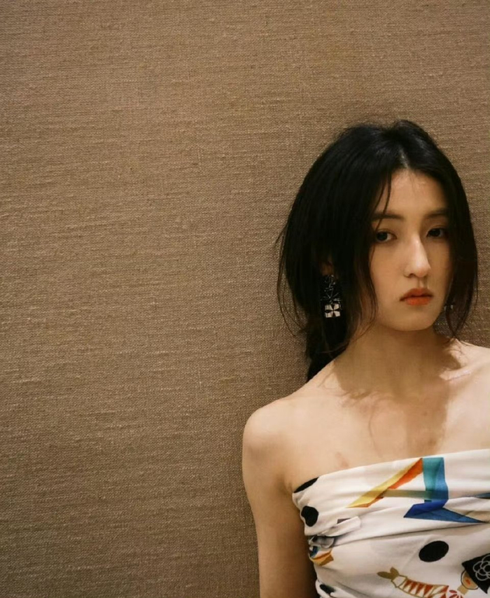 Sao nữ gen Z lộ vết bầm bất thường tr&ecirc;n ngực v&agrave; c&aacute;nh tay - Ảnh 1.