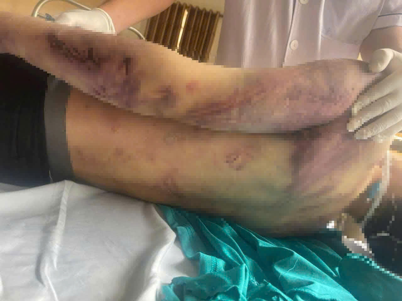 Tạm đ&igrave;nh chỉ Trung t&acirc;m C&ocirc;ng t&aacute;c x&atilde; hội Hải H&agrave; điều tra vụ học vi&ecirc;n tử vong - Ảnh 1.