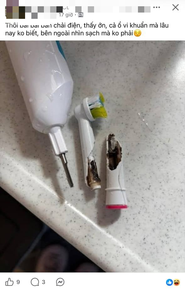 Cận cảnh thứ b&ecirc;n trong của b&agrave;n chải điện khiến nhiều người r&ugrave;ng m&igrave;nh: BS n&oacute;i g&igrave;?- Ảnh 1.