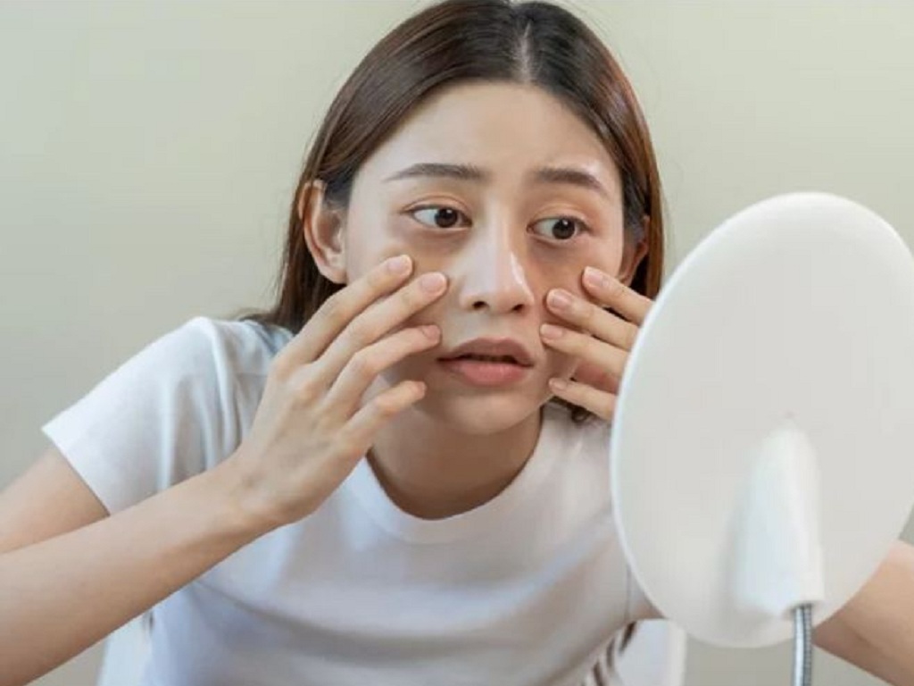 Những bất thường ở v&ugrave;ng đầu cảnh b&aacute;o ung thư phổi? Nếu c&oacute; 3 dấu hiệu n&agrave;y h&atilde;y đi kh&aacute;m c&agrave;ng sớm c&agrave;ng tốt!- Ảnh 3.