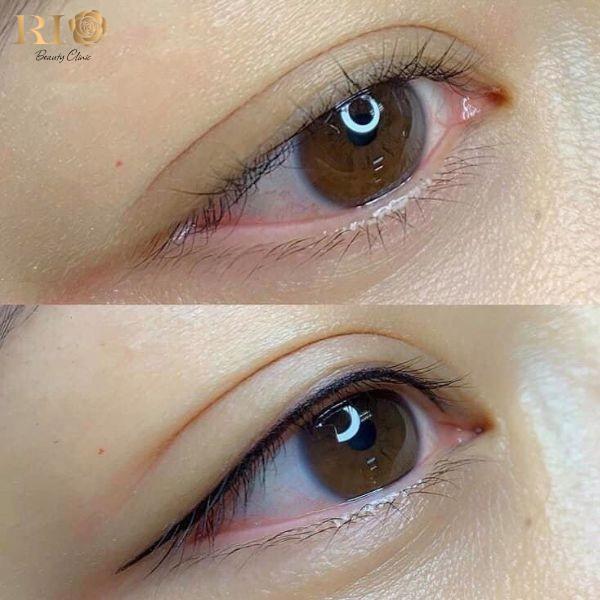 Phun m&iacute; Glamor tạo điểm nhấn cho đ&ocirc;i mắt tại Thẩm Mỹ Rio - Ảnh 1.