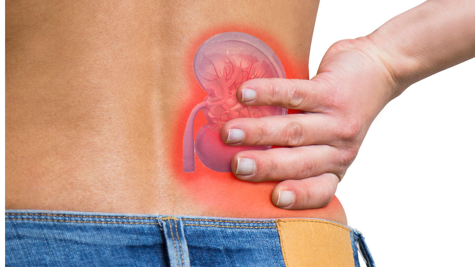 Người đ&agrave;n &ocirc;ng 32 tuổi ph&aacute;t hiện ung thư thận nhờ l&agrave;m 1 việc v&agrave;o th&aacute;ng 9- Ảnh 3.