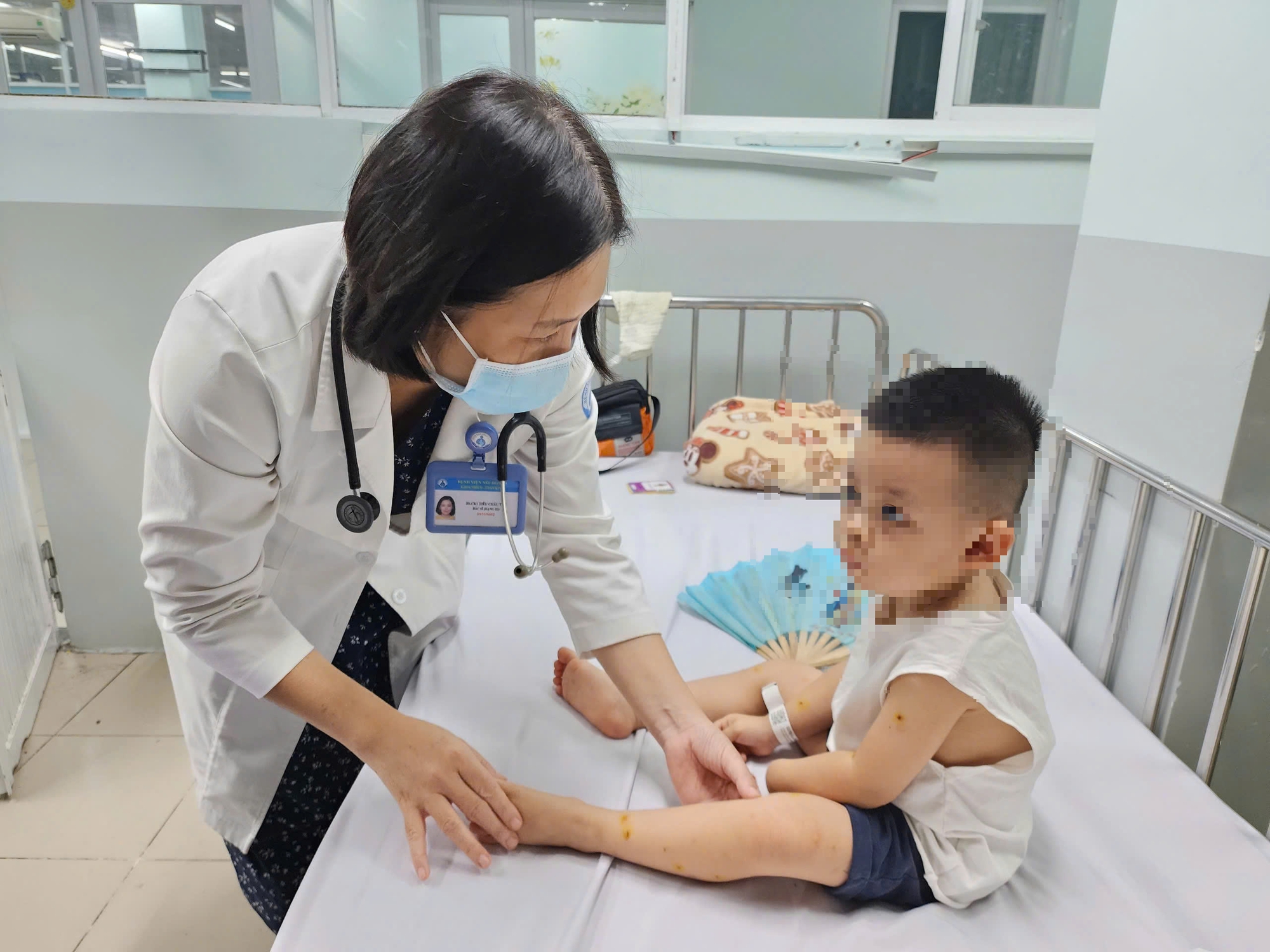 1 tuần TPHCM có hơn 1.500 ca tay chân miệng, Sở Y tế TP HCM lý giải nguyên nhân - Ảnh 2.