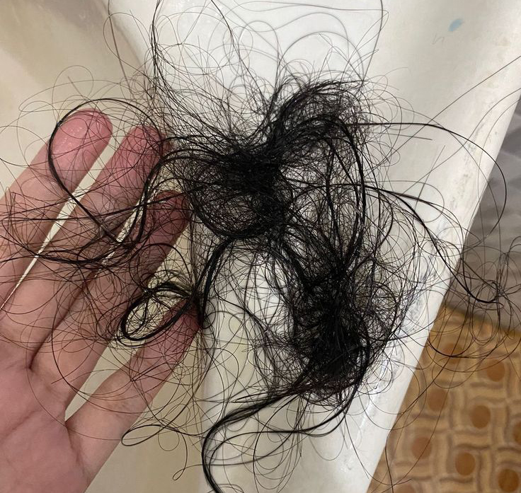 - Ảnh 3. - Ảnh 3.