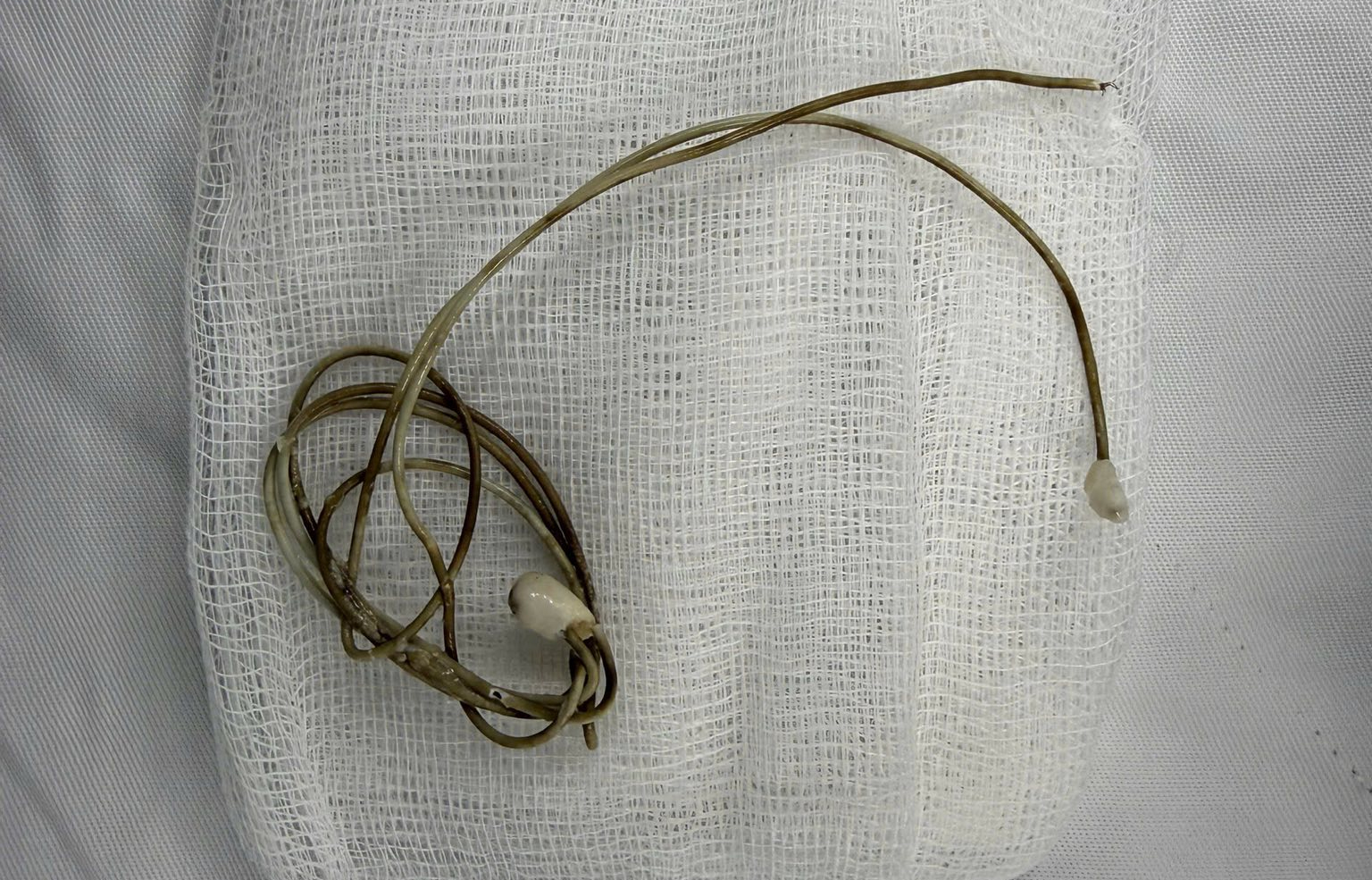 “Tạo cảm giác lạ”, một bé trai đưa dây sạc vào vùng kín - Ảnh 2.