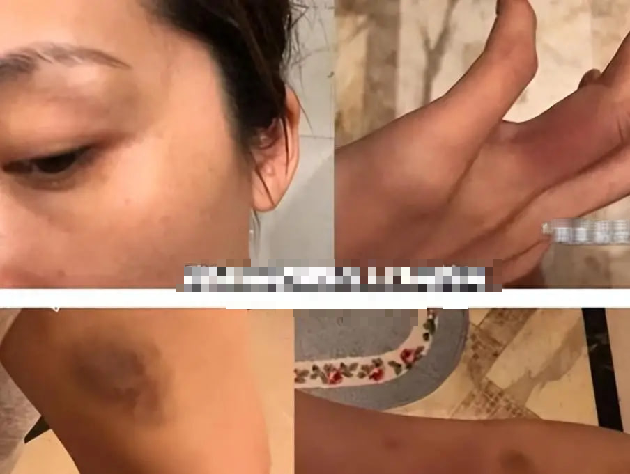 - Ảnh 7. - Ảnh 7.