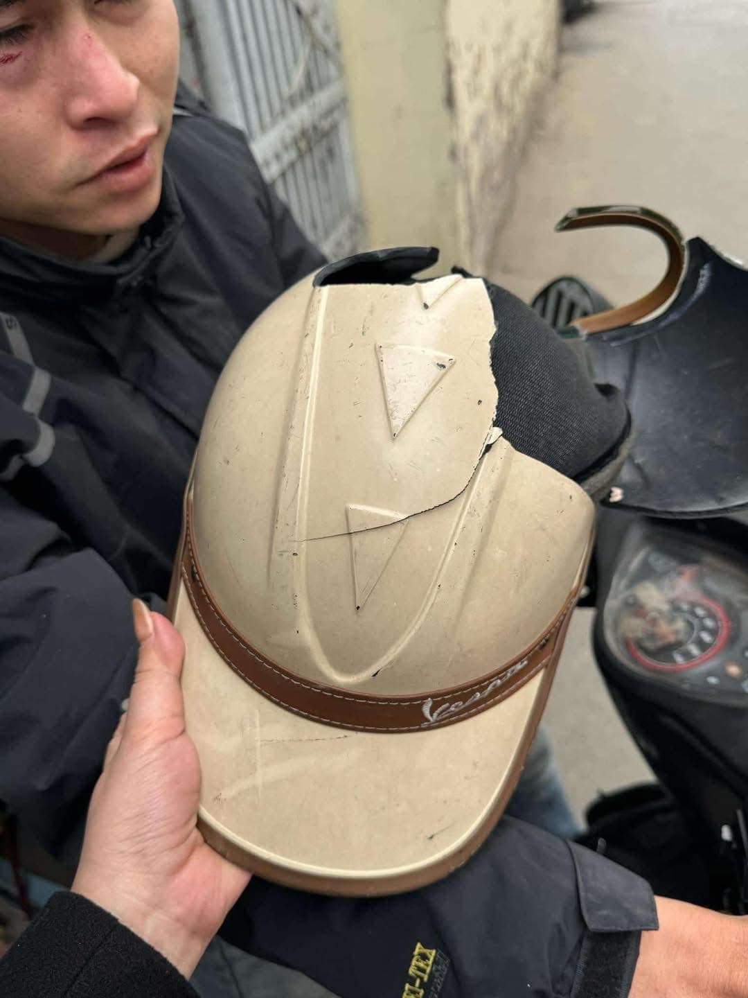 Tài xế Lexus đánh shipper cụt tay tại Hà Nội gây phẫn nộ mạng xã hội - Ảnh 2.