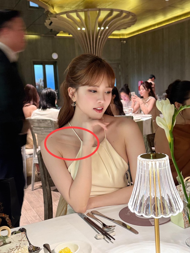 Chi tiết bí ẩn nhất trên cơ thể Thiều Bảo Trâm - Ảnh 1. Chi tiết bí ẩn nhất trên cơ thể Thiều Bảo Trâm - Ảnh 1.