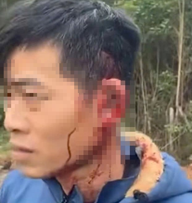 Vợ nhập viện khi dùng điện thoại livestream việc chồng bị đánh- Ảnh 1. Vợ nhập viện khi dùng điện thoại livestream việc chồng bị đánh- Ảnh 1.