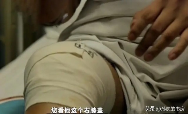 Nửa đêm đau nhói ở gối, người đàn ông phải nhập viện liền được bác sĩ yêu cầu: Gọi cảnh sát ngay lập tức! - Ảnh 1.