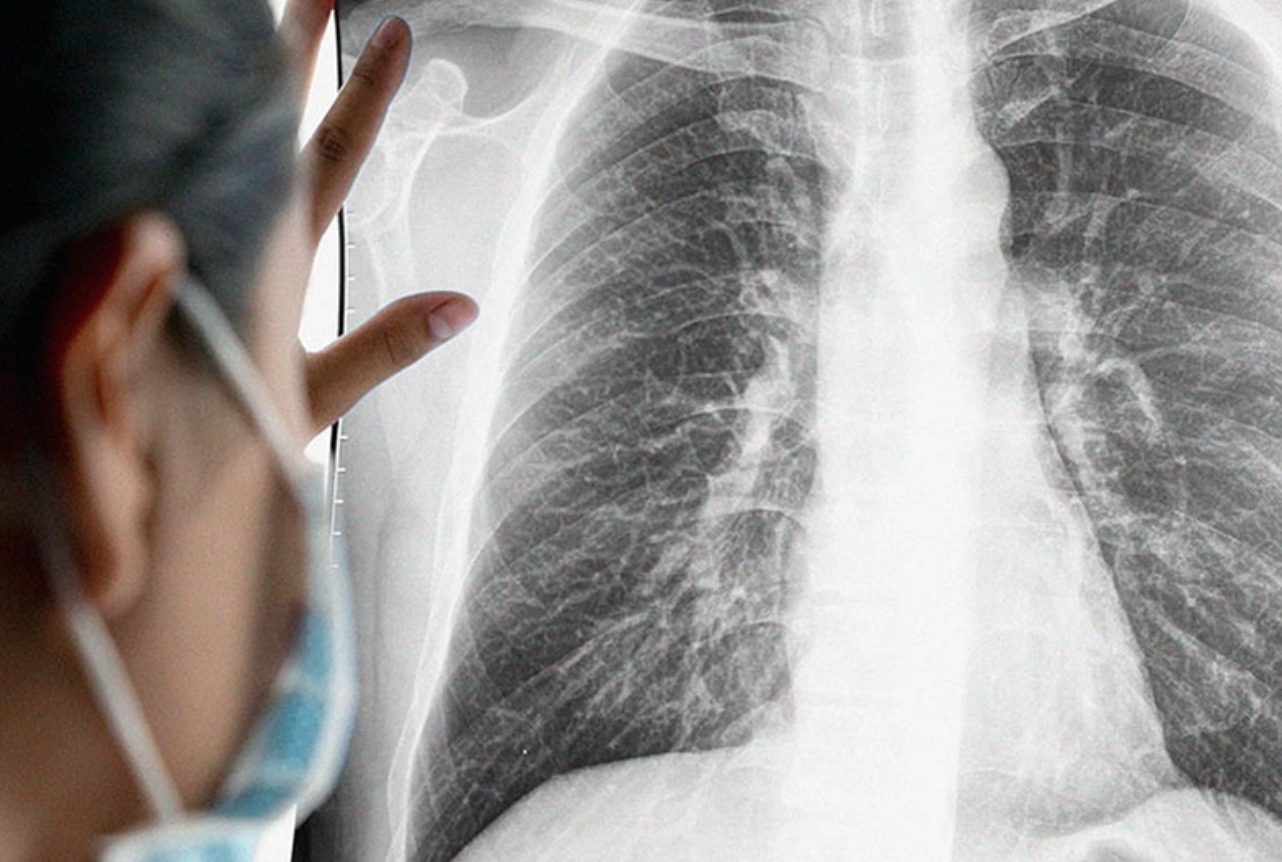 Bệnh nhân ung thư 'chạy' khỏi phòng mổ sau khi nghe 1 cuộc điện thoại: Bác sĩ sững người khi biết lý do - Ảnh 2.