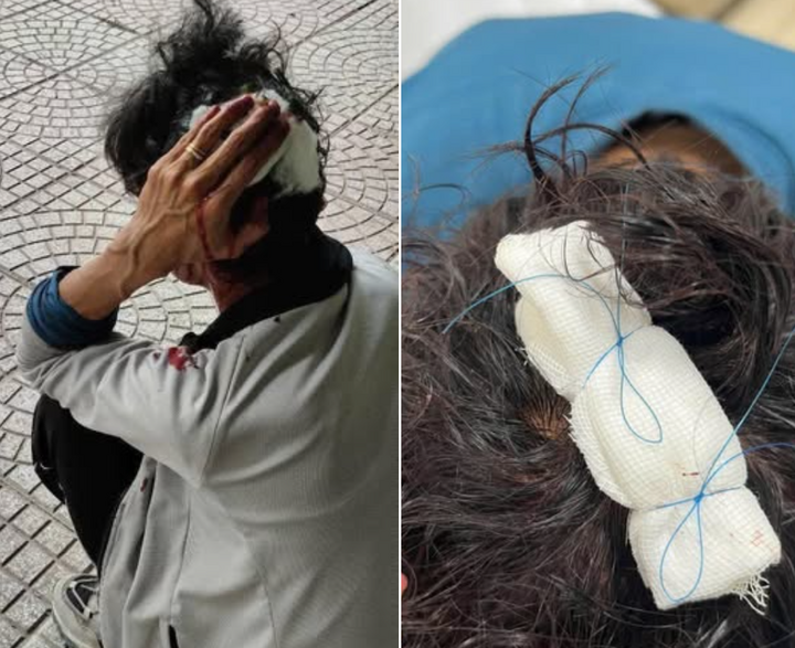 X&aacute;c minh vụ shipper B&igrave;nh Dương bị ch&eacute;m khi giao h&agrave;ng - Ảnh 2.