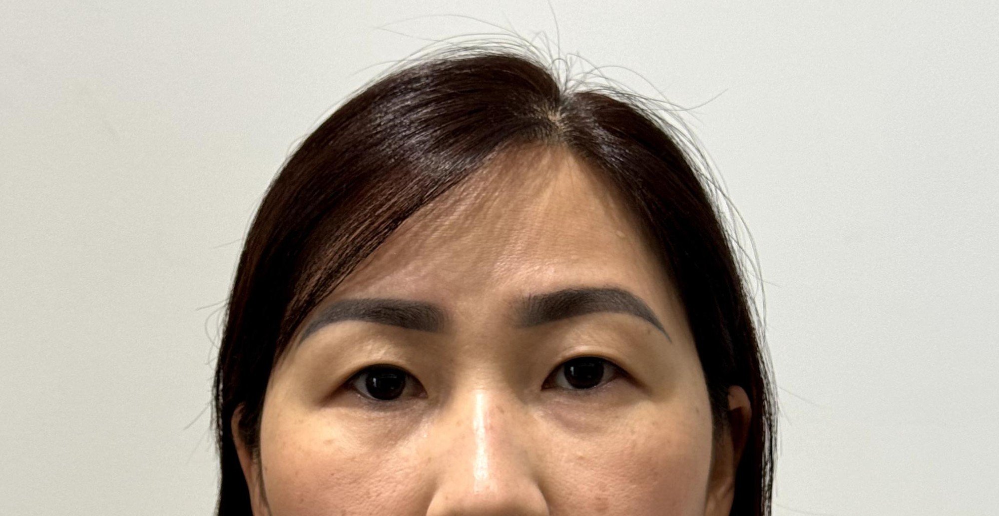 Hành trình trẻ hóa đôi mắt, lấy lại sự tự tin cho người mẹ hai con - chị Vòng Xuân Hạnh - Ảnh 1. Hành trình trẻ hóa đôi mắt, lấy lại sự tự tin cho người mẹ hai con - chị Vòng Xuân Hạnh - Ảnh 1.