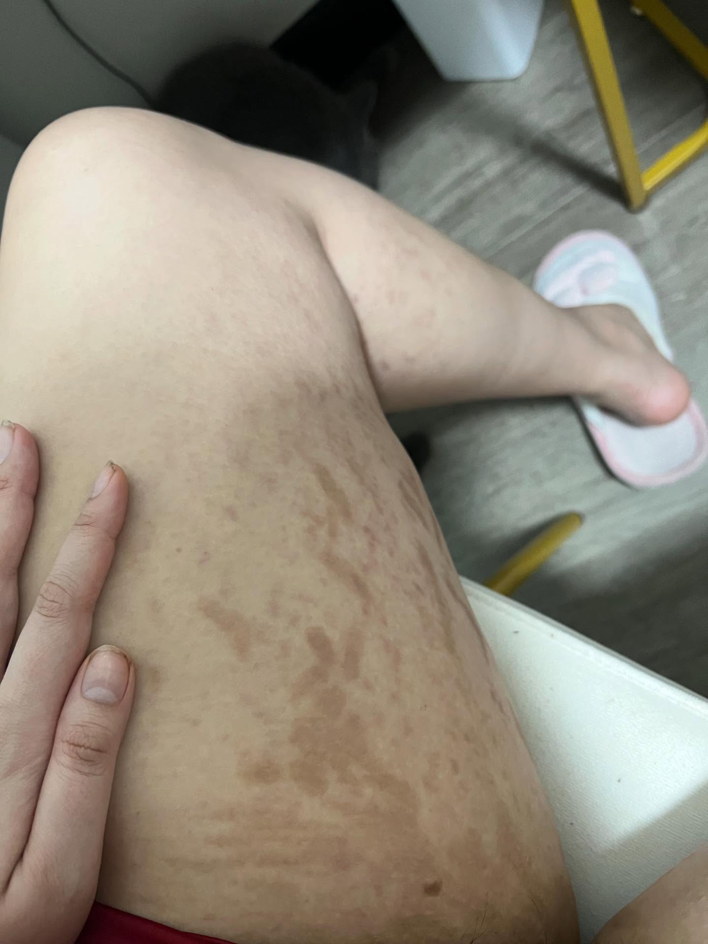 Trúc Anh (Mắt Biếc) thừa nhận bị trầm cảm, công khai những hình ảnh gây xót xa khi tăng cân- Ảnh 7. Trúc Anh (Mắt Biếc) thừa nhận bị trầm cảm, công khai những hình ảnh gây xót xa khi tăng cân- Ảnh 7.