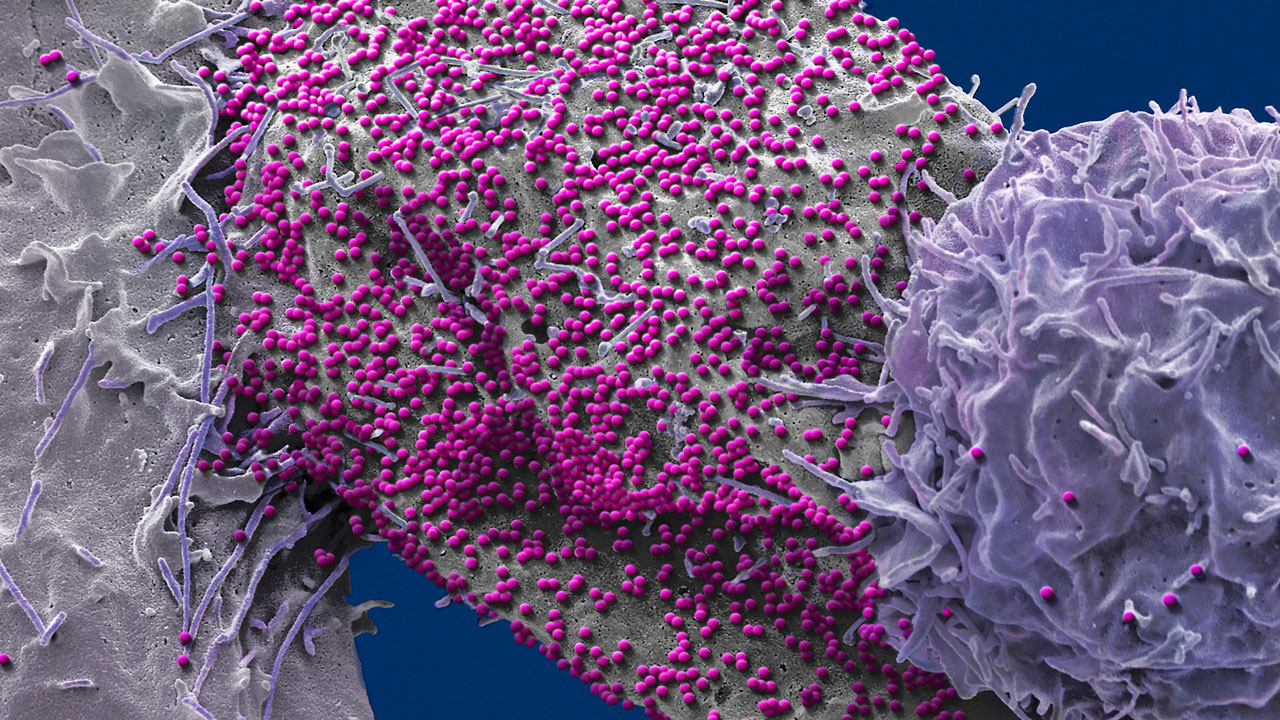 Chuyến bay MH17: Mất mát lớn của nghiên cứu HIV/AIDS toàn cầu - Ảnh 14.