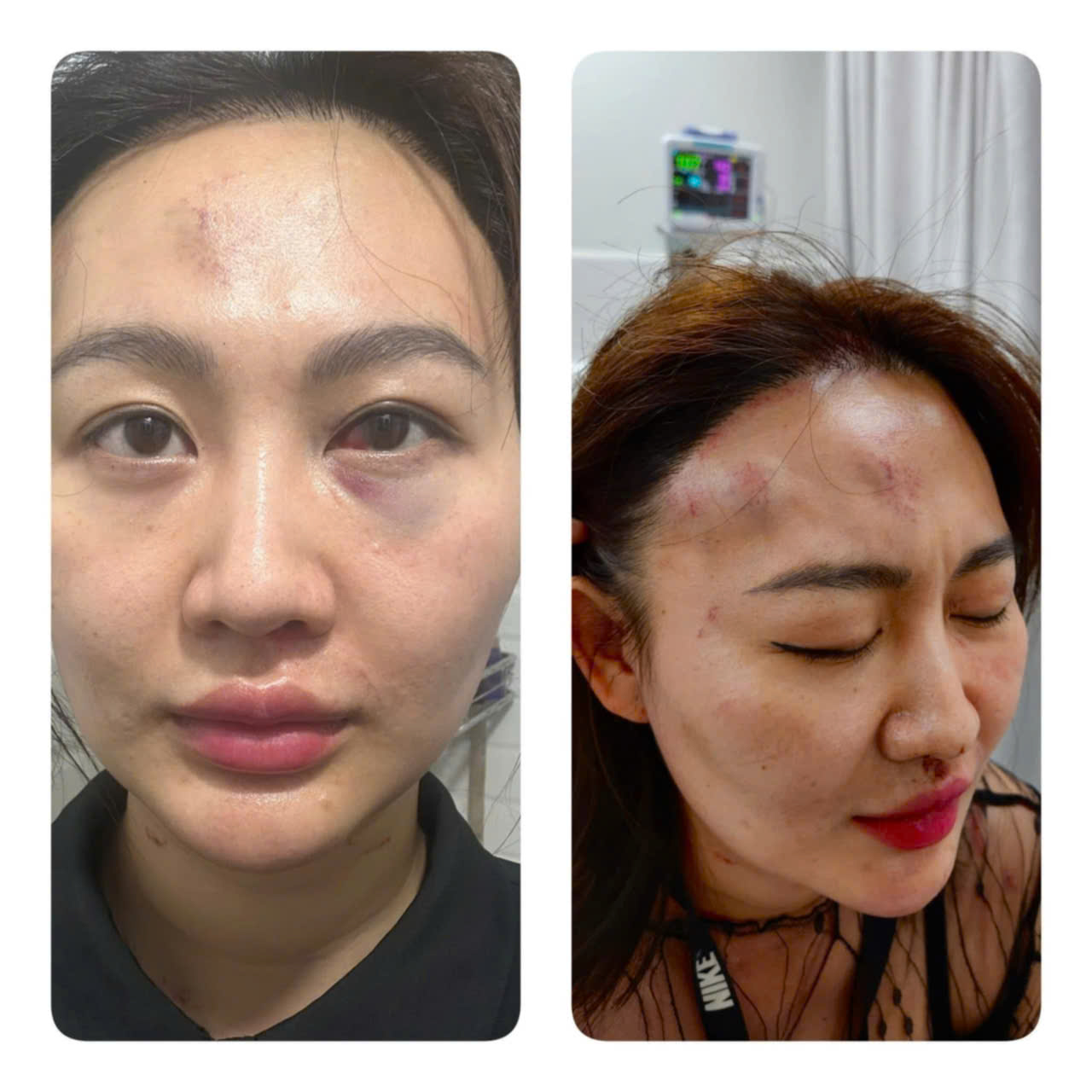 Công an TP HCM bắt thanh niên tấn công bạn gái ở quán cà phê- Ảnh 1. Công an TP HCM bắt thanh niên tấn công bạn gái ở quán cà phê- Ảnh 1.