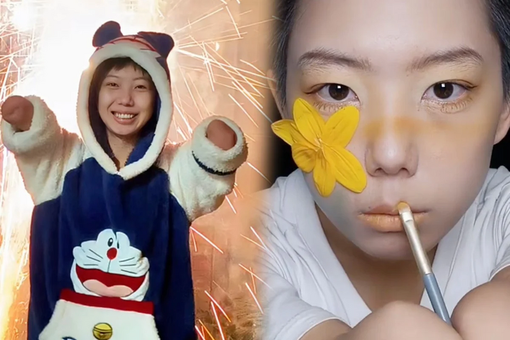 Cô gái mất cả tay trở thành chuyên gia trang điểm và vận động viên cưỡi ngựa - Ảnh 1.