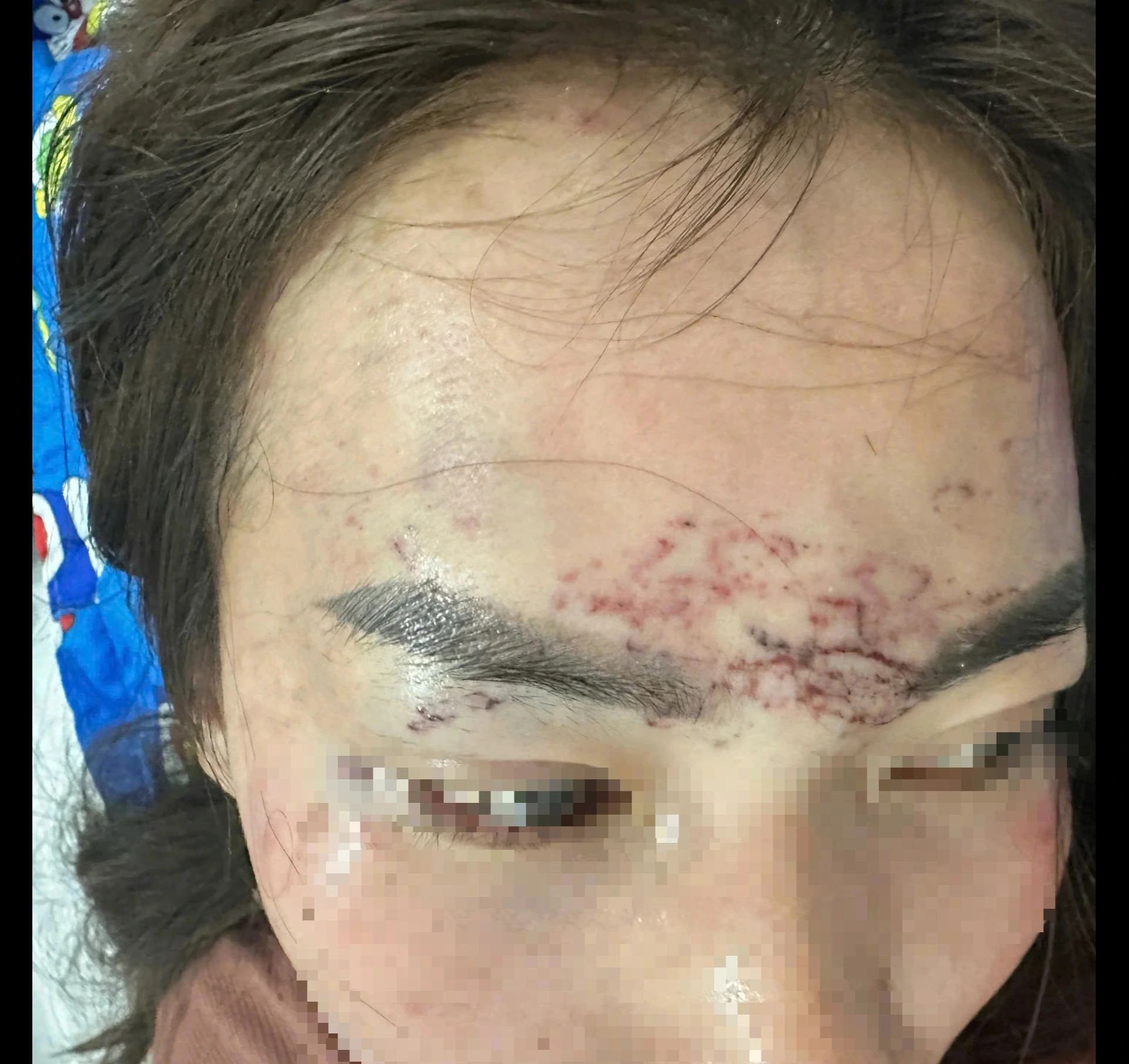 Phụ nữ bị h&agrave;nh hung ở C&agrave; Mau: Bị xăm mặt v&agrave; cắt t&oacute;c v&igrave; ghen tu&ocirc;ng - Ảnh 1.