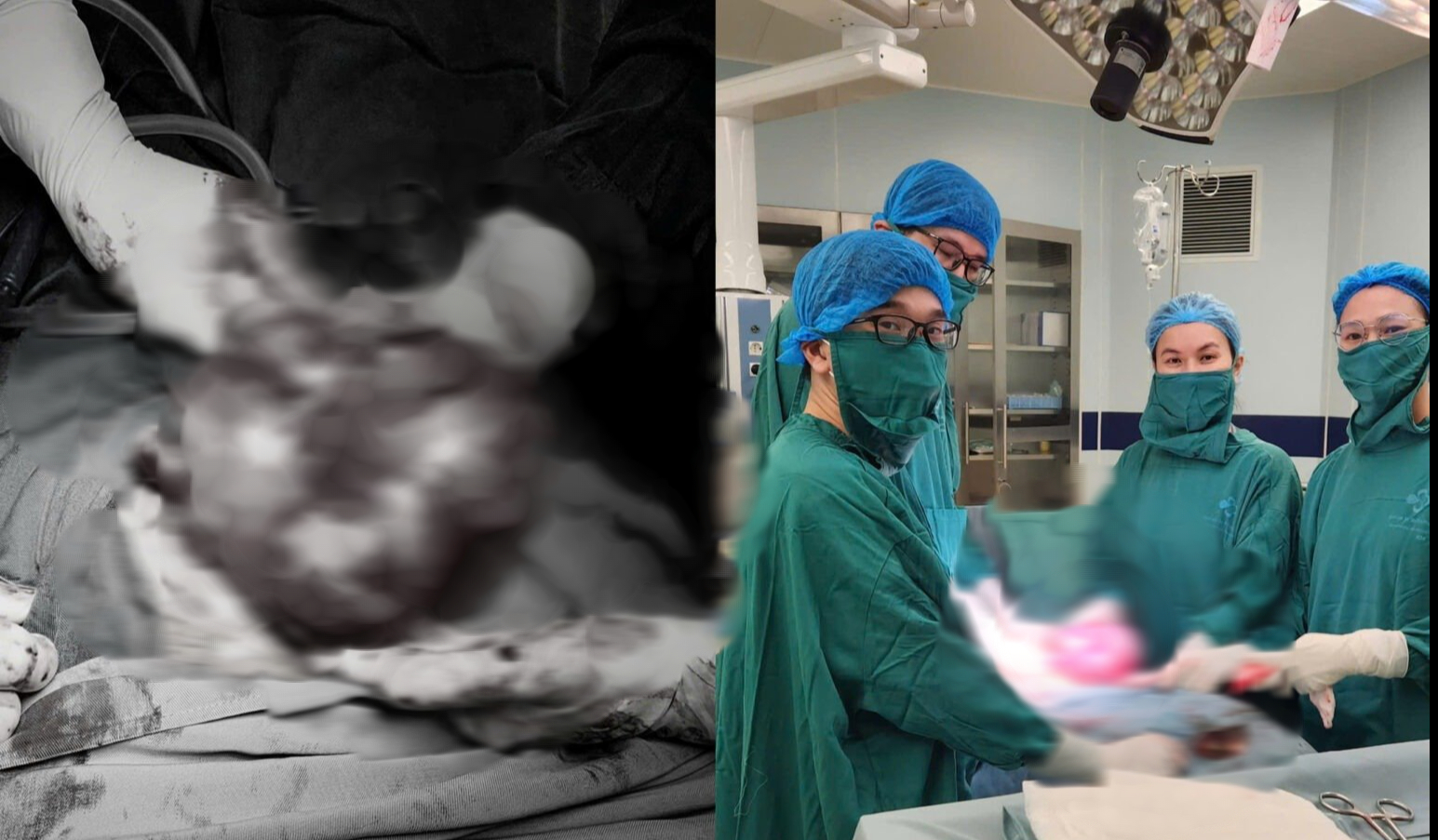 Khối u to nhanh do lạm dụng thực phẩm chức năng- Ảnh 1.