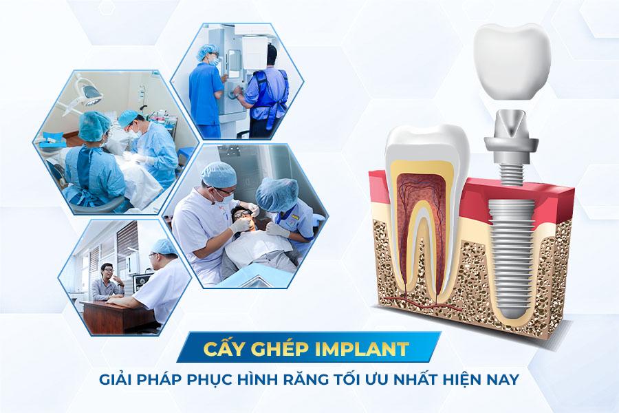 17 tuổi nhổ răng c&oacute; mọc lại kh&ocirc;ng? Phải l&agrave;m sao - Ảnh 2.