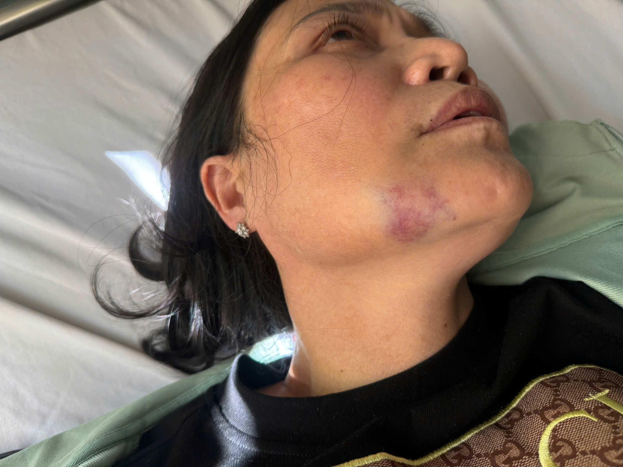 Khởi tố 2 anh em đánh nữ y sĩ tới tấp - Ảnh 1.