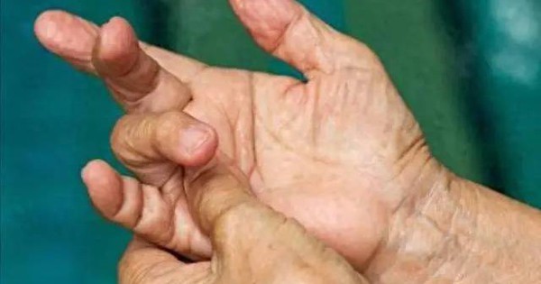 V&igrave; sao ng&oacute;n tay nhăn nheo khi ng&acirc;m nước? - Ảnh 4.