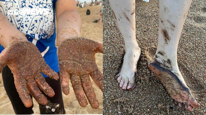 Dầu vón cục dính người tắm biển ở tuy hòa , Phú Yên gây lo lắng cho du khách - Ảnh 2.