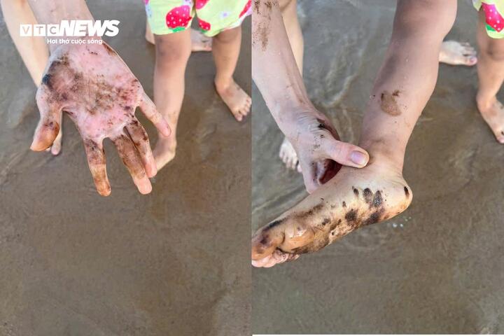 Dầu vón cục dính người tắm biển ở tuy hòa , Phú Yên gây lo lắng cho du khách - Ảnh 3.