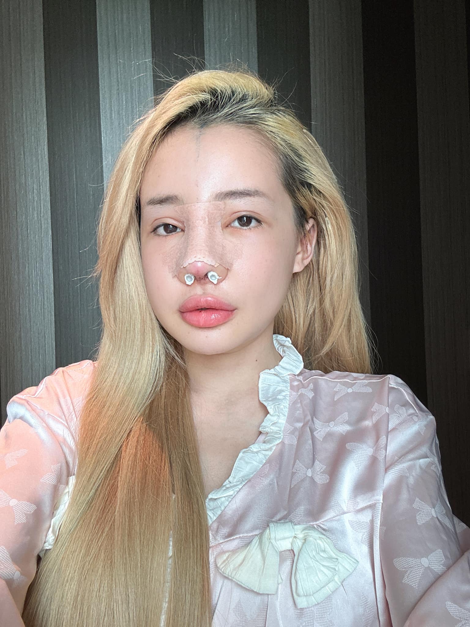 Ngân 98 "nghiện" phẫu thuật thẩm mỹ, chuẩn bị "đập mặt xây lại" lần thứ 12- Ảnh 5. Ngân 98 "nghiện" phẫu thuật thẩm mỹ, chuẩn bị "đập mặt xây lại" lần thứ 12- Ảnh 5.