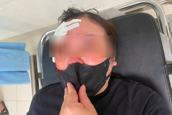 Người trên ô tô bán tải bị tố vụt dùi cui vào đầu nữ tài xế nói gì về nguyên nhân?- Ảnh 1.