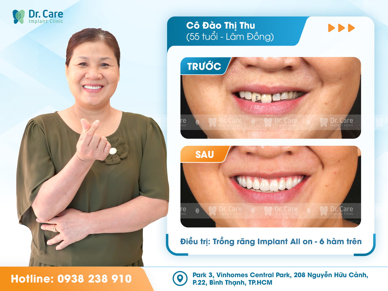 Trồng răng implant toàn hàm tuổi trung niên: Đừng chọn sai nha khoa - Ảnh 1.
