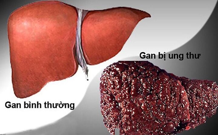 - Ảnh 1.