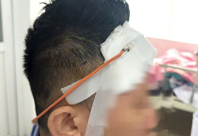 Ngã xe máy, một tháng sau mới lộ chấn thương sọ não- Ảnh 1.