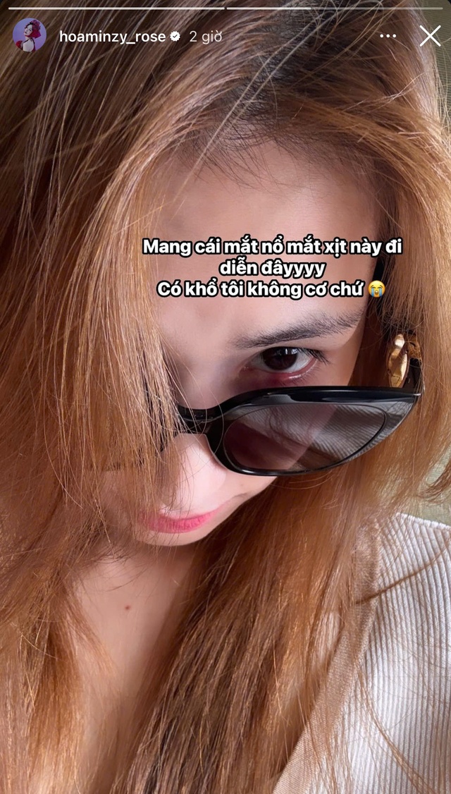 Tình trạng gây lo lắng của Hòa Minzy- Ảnh 2. Tình trạng gây lo lắng của Hòa Minzy- Ảnh 2.