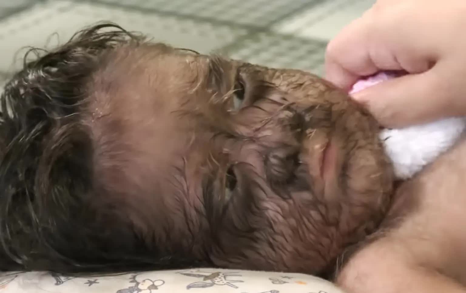 Vì sao bé gái "người sói" đầy lông lá này được gọi là "đứa trẻ đến từ thiên đường"? - Ảnh 1.