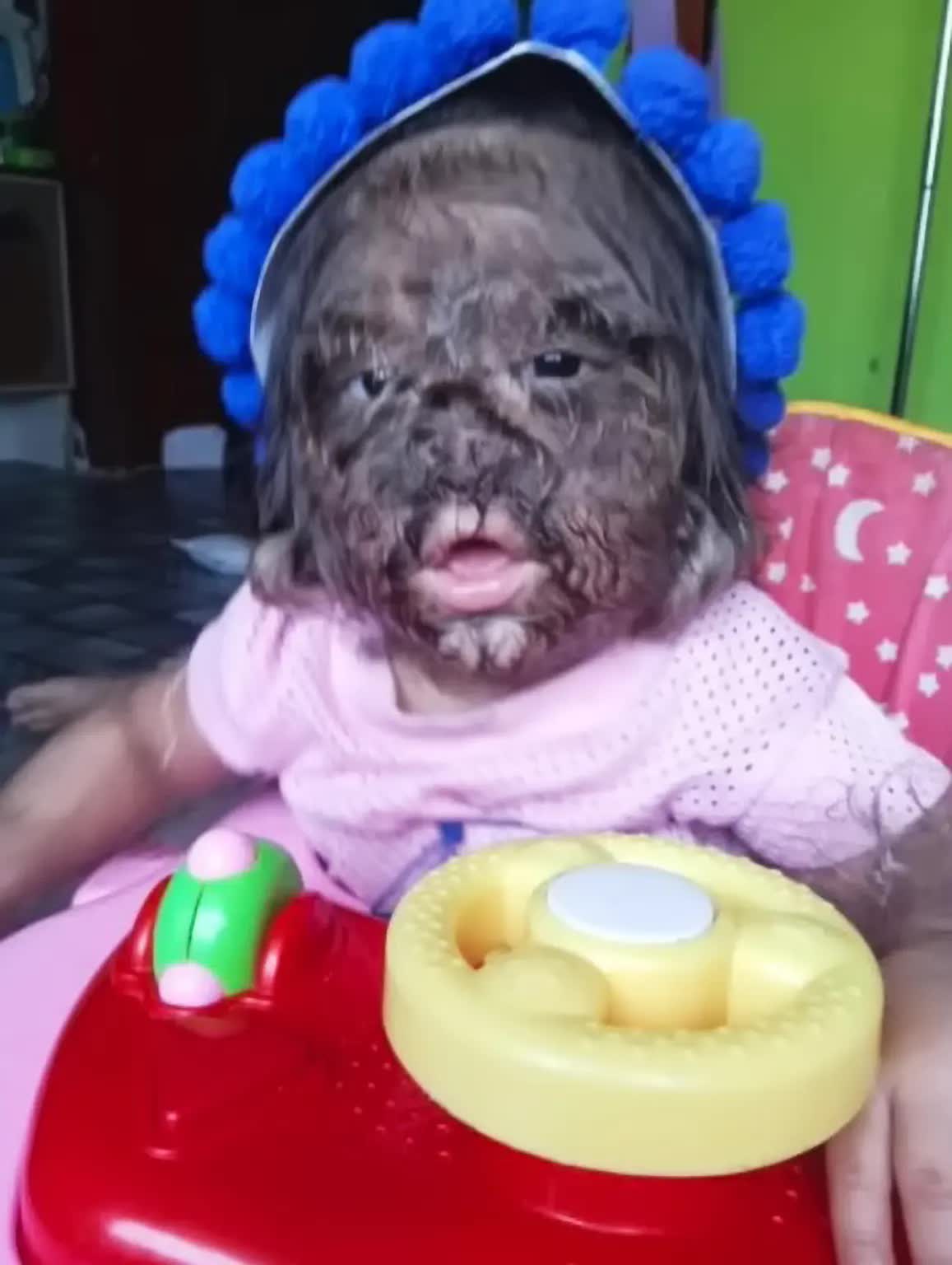 Vì sao bé gái "người sói" đầy lông lá này được gọi là "đứa trẻ đến từ thiên đường"? - Ảnh 3.