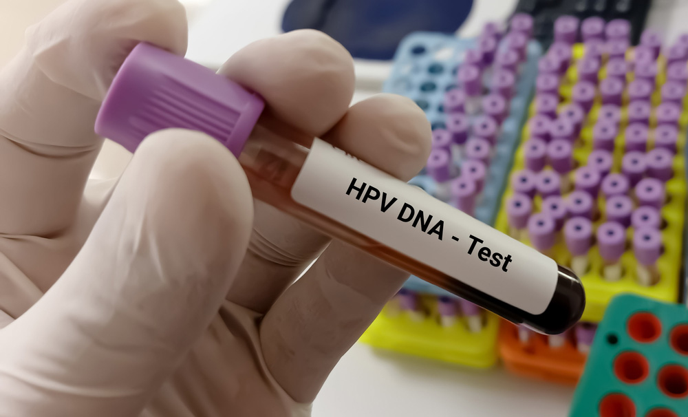 Ti&ecirc;m vắc xin HPV bao l&acirc;u th&igrave; c&oacute; hiệu quả? - Ảnh 2.