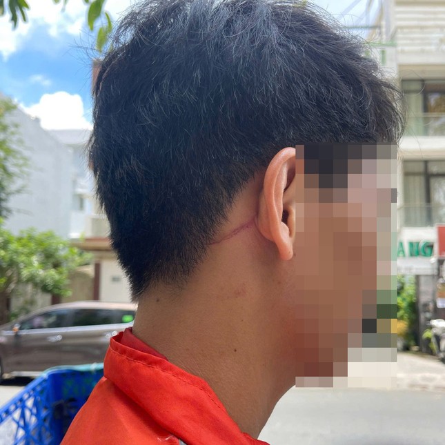 Điều tra vụ nam shipper TPHCM bị đánh gãy sống mũi tại chung cư An Phú - Ảnh 2.