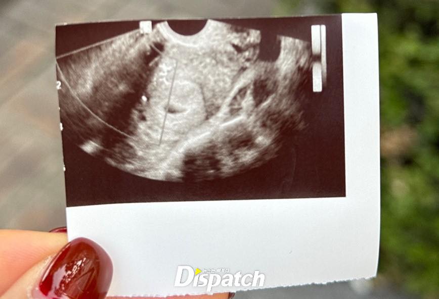 Dispatch vào cuộc vụ Son Heung-min bị tống tiền, tiết lộ gây sốc: Bạn gái cũ có thai nhưng không biết là con của ai- Ảnh 2.