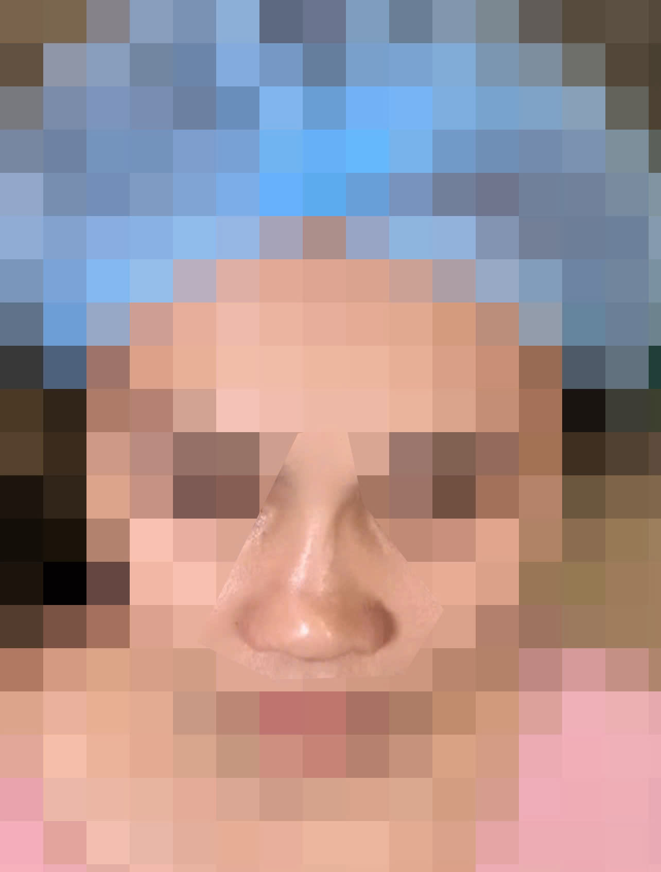 Nữ sinh 22 tuổi mắt kh&ocirc;ng nhắm k&iacute;n, chảy nước mắt li&ecirc;n tục v&igrave; th&oacute;i quen l&agrave;m đẹp "bất chấp" của nhiều người- Ảnh 2.