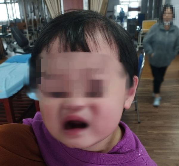 B&eacute; 5 tuổi bị liệt nửa mặt đột ngột: Cảnh b&aacute;o cha mẹ về căn bệnh trẻ c&oacute; thể gặp do nằm quạt, điều h&ograve;a trong m&ugrave;a h&egrave;- Ảnh 2.