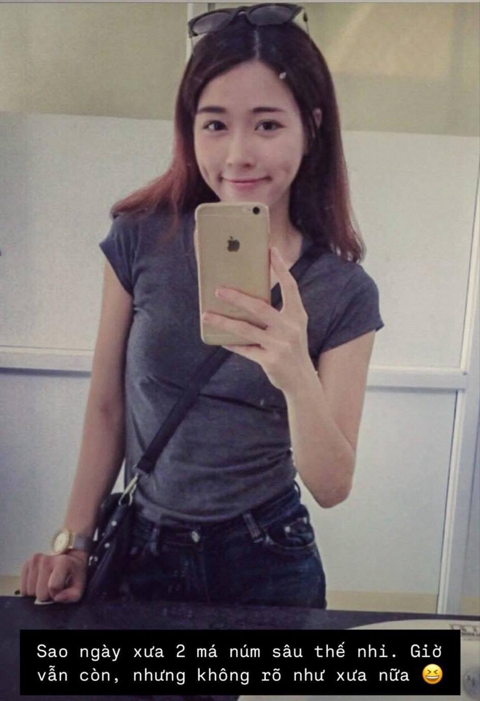 Lộ ảnh lúc chưa thẩm mỹ của bạn gái Văn Thanh, visual vẫn cực hot chuẩn tiểu thư xuất thân “trâm anh thế phiệt