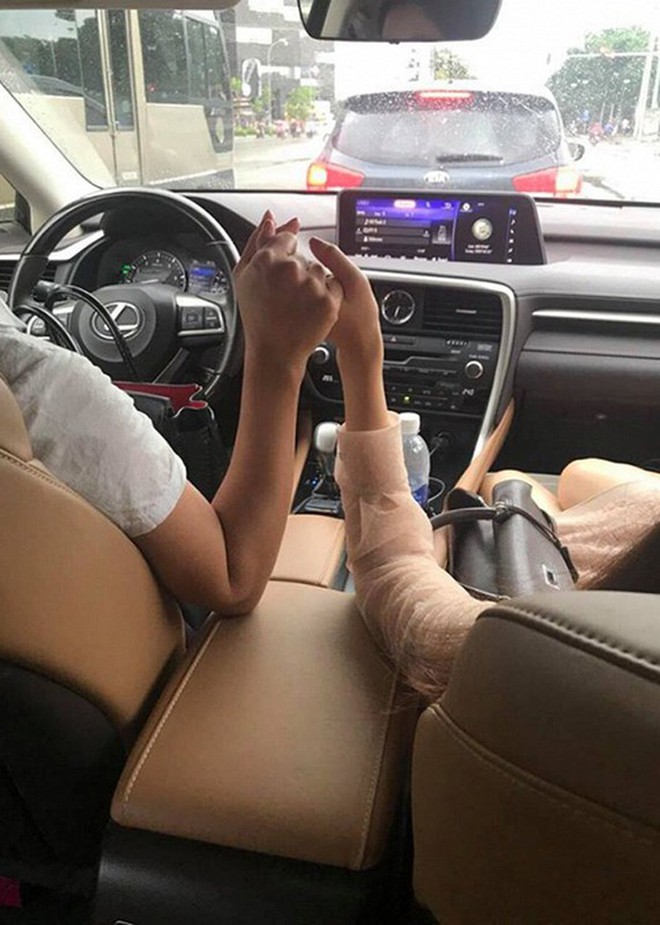 - Ảnh 4.