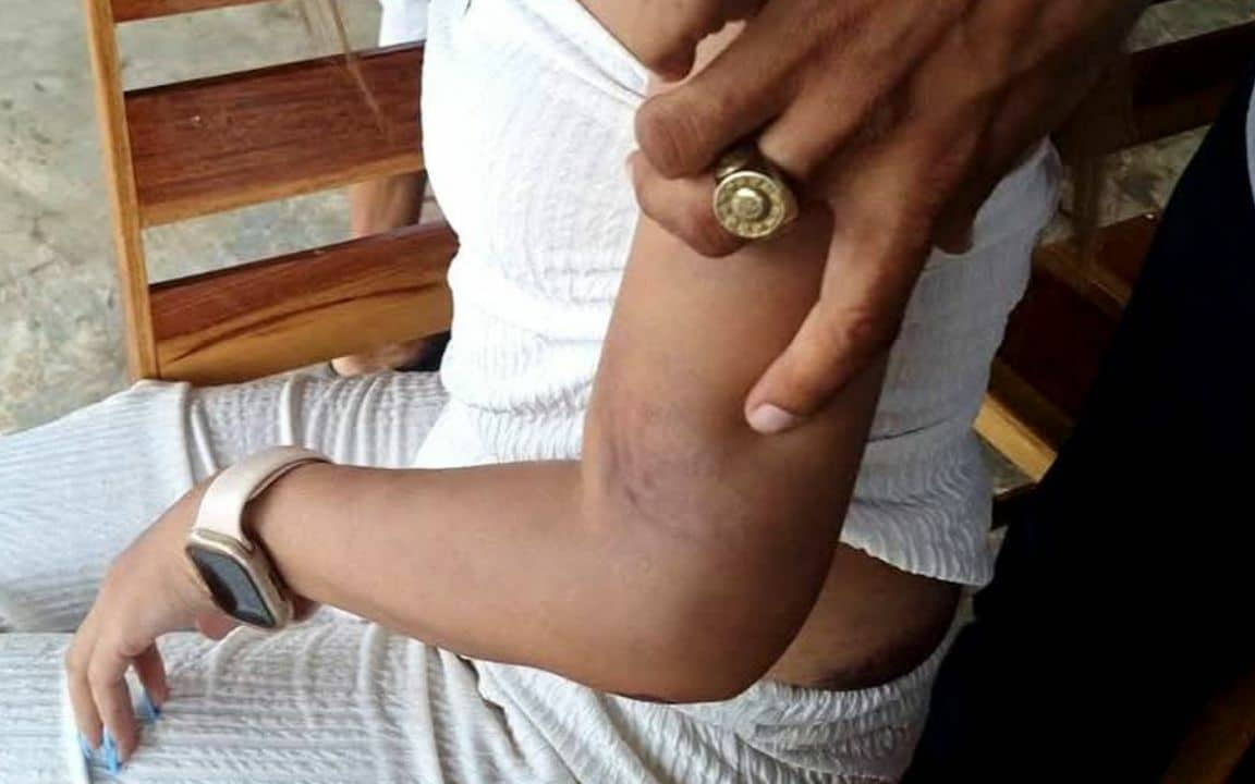 Bạn trai qua lại với 6 phụ nữ kh&aacute;c, c&ocirc; g&aacute;i hỏi đến liền bị đối phương tấn c&ocirc;ng, phải nhảy khỏi ban c&ocirc;ng