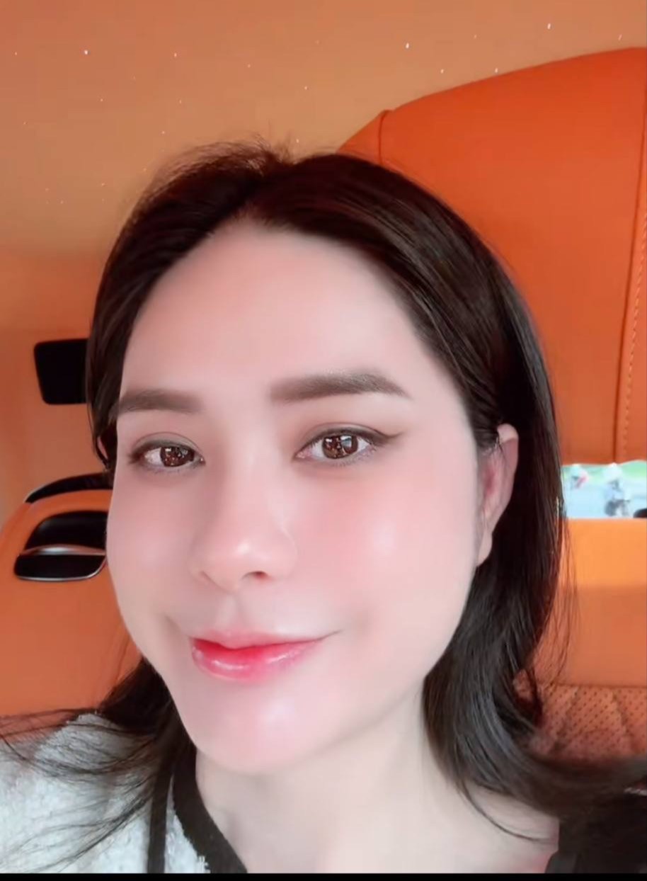 - Ảnh 4.