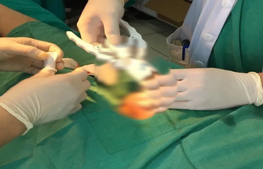 Tưởng bệnh tình dục phổ biến, ai ngờ là ung thư dương vật- Ảnh 1.