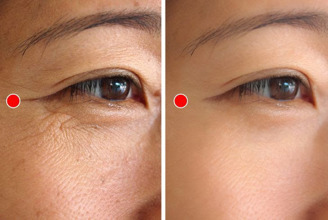 Bóc trần 4 lầm tưởng về chống lão hóa, tiết lộ 2 bí quyết thực sự ngăn ngừa nếp nhăn ít người biết- Ảnh 3.