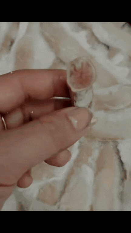 Sự thật về m&oacute;n l&ograve;ng se điếu đắt đỏ đang g&acirc;y tranh c&atilde;i những ng&agrave;y qua: Người n&oacute;i ph&egrave;o 2 da, người n&oacute;i do bệnh- Ảnh 4.