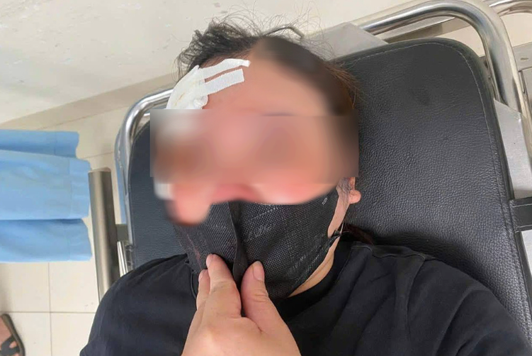 Nữ t&agrave;i xế "tố" bị t&agrave;i xế xe b&aacute;n tải d&ugrave;ng d&ugrave;i cui vụt v&agrave;o đầu - Ảnh 1.